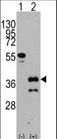 Western blot of ZIC4 (arrow) using rabbit polyclonal ZIC4 Antibody. 293 cell lysates (2 ug/lane) either nontransfected (Lane 1) or transiently transfected with the ZIC4 gene (Lane 2) (Origene Technologies).
