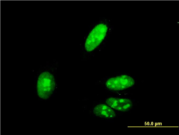 Immunofluorescence of monoclonal antibody to ZIC4 on HeLa cell (antibody concentration 10 ug/ml).