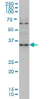 ZIC4 monoclonal antibody (M09), clone 3A2 Western blot of ZIC4 expression in HeLa NE.