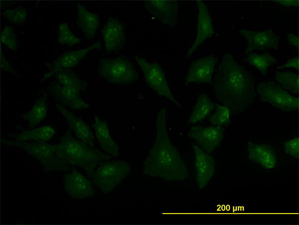 Immunofluorescence of monoclonal antibody to ZIC4 on HeLa cell (antibody concentration 10 ug/ml).