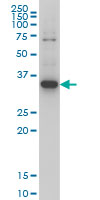 ZIC4 monoclonal antibody (M05), clone 1A9 Western blot of ZIC4 expression in HeLa NE.