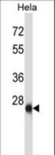 ZIC4 Antibody western blot of HeLa cell line lysates (35 ug/lane). The ZIC4 antibody detected the ZIC4 protein (arrow).