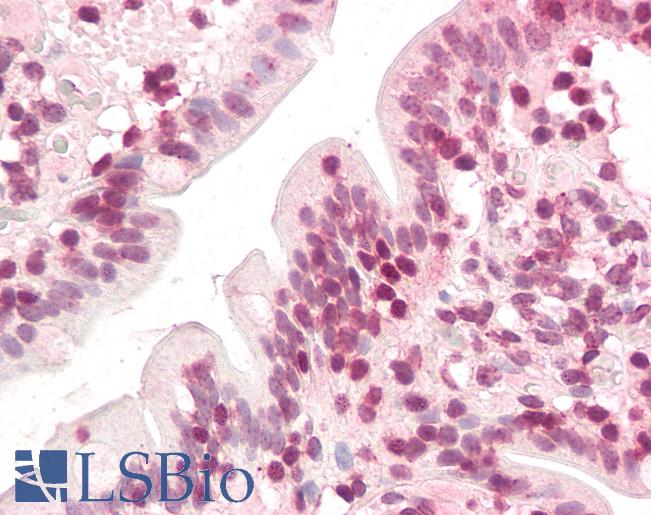Anti-ZIC5 antibody IHC of human small intestine. Immunohistochemistry of formalin-fixed, paraffin-embedded tissue after heat-induced antigen retrieval. Antibody LS-B3233 concentration 3.75 ug/ml.