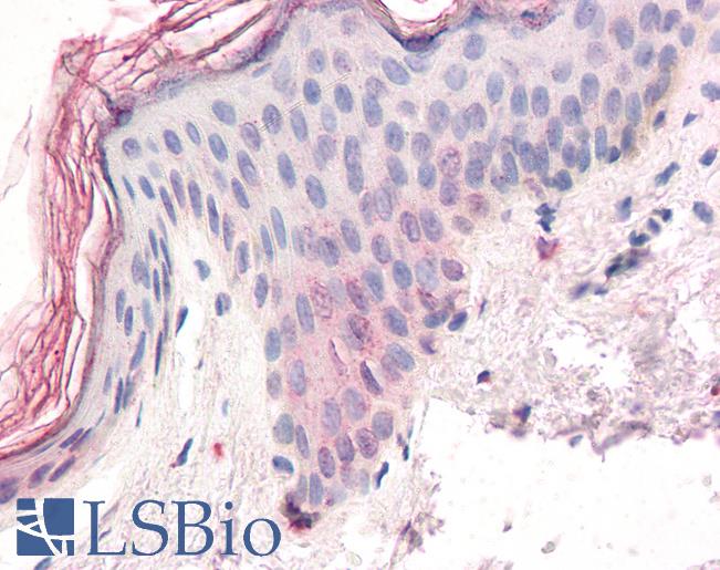 Anti-ZIC5 antibody IHC of human skin. Immunohistochemistry of formalin-fixed, paraffin-embedded tissue after heat-induced antigen retrieval. Antibody LS-B3233 concentration 3.75 ug/ml.