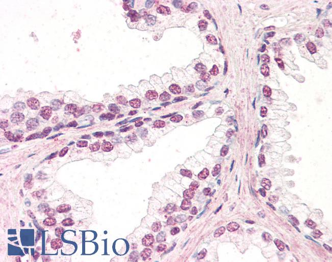 Anti-ZIC5 antibody IHC of human prostate. Immunohistochemistry of formalin-fixed, paraffin-embedded tissue after heat-induced antigen retrieval. Antibody LS-B3233 concentration 3.75 ug/ml.