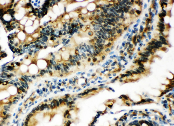 ZIF268 / EGR1 antibody. IHC(P): Rat Intestine Tissue.