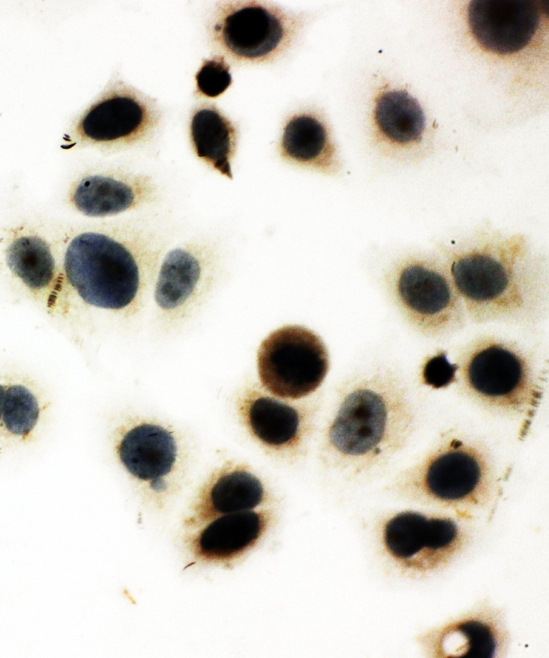 ZIF268 / EGR1 antibody. ICC: MCF-7 Cell.
