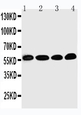 WB of ZIF268 / EGR1 antibody. Lane 1: Rat Brain Tissue Lysate. Lane 2: HELA Cell Lysate. Lane 3: MCF-7 Cell Lysate. Lane 4: COLO320 Cell Lysate.