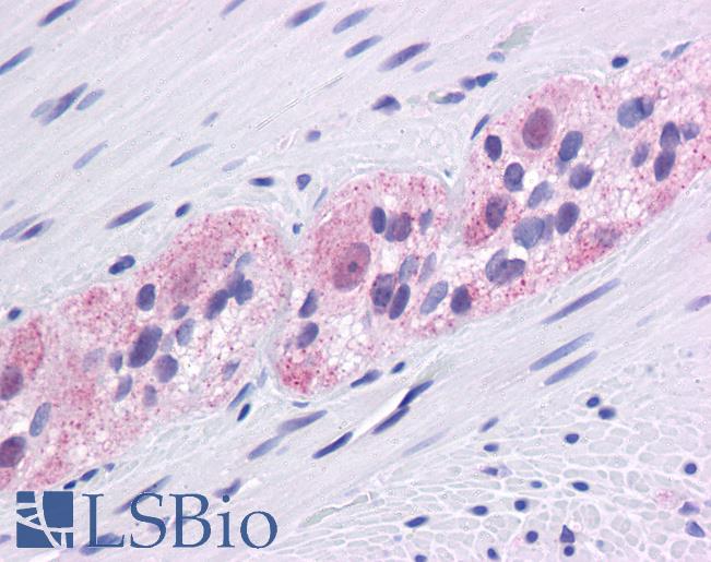 Anti-EGR1 antibody IHC of human colon, myenteric plexus. Immunohistochemistry of formalin-fixed, paraffin-embedded tissue after heat-induced antigen retrieval. Antibody LS-B4566 concentration 5 ug/ml.