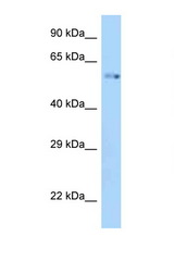 ZIK1 antibody LS-C146144 Western blot of Mouse Kidney lysate. Antibody concentration 1 ug/ml.
