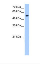Jurkat cell lysate. Antibody concentration: 1.25 ug/ml. Gel concentration: 12%.