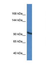 ZMIZ2 antibody LS-C145494 Western blot of A549 Cell lysate. Antibody concentration 1 ug/ml.