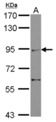 Sample (30 ug of whole cell lysate) A: IMR32 7.5% SDS PAGE ZMIZ2 antibody diluted at 1:500