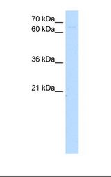 Jurkat cell lysate. Antibody concentration: 5.0 ug/ml. Gel concentration: 12%.