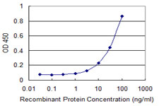 Detection limit for recombinant GST tagged ZKSCAN1 is 1 ng/ml as a capture antibody.