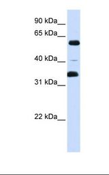 Fetal brain lysate. Antibody concentration: 1.0 ug/ml. Gel concentration: 12%.