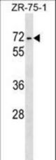 ZKSCAN1 Antibody western blot of ZR-75-1 cell line lysates (35 ug/lane). The ZKSCAN1 antibody detected the ZKSCAN1 protein (arrow).