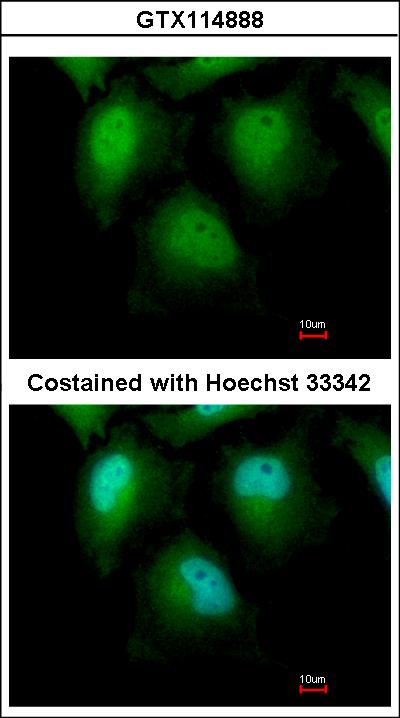 Immunofluorescence of paraformaldehyde-fixed HeLa, using ZKSCAN1 antibody at 1:500 dilution.