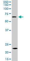 ZKSCAN3 monoclonal antibody (M16), clone 2A5. Western blot of ZKSCAN3 expression in HepG2.