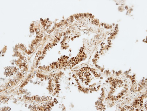 IHC of paraffin-embedded normal lung using ZKSCAN3 antibody at 1:100 dilution.