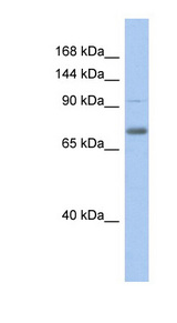 ZKSCAN5 / ZFP95 antibody LS-C109678 Western blot of Fetal Stomach lysate.