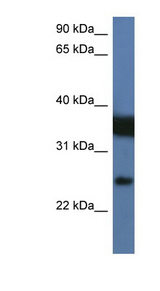 ZMAT2 antibody LS-C135106 Western blot of Jurkat lysate.