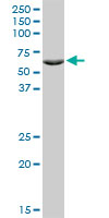 ZNF133 monoclonal antibody (M01), clone 1C6. Western Blot analysis of ZNF133 expression in SJCRH30.