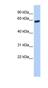ZNF133 antibody LS-C101563 Western blot of 721_B cell lysate.