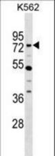 ZNF133 Antibody western blot of K562 cell line lysates (35 ug/lane). The ZNF133 antibody detected the ZNF133 protein (arrow).