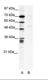 A: Marker, B: HepG2 Cell Lysate