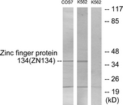 Western blot of extracts from COS7/K562 cells, using ZNF134 Antibody. The lane on the right is treated with the synthesized peptide.
