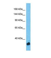Western blot of Human Thyroid Tumor. ZNF134 antibody dilution 1.0 ug/ml.