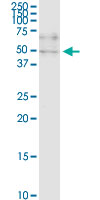 ZNF134 monoclonal antibody (M03), clone 2D10. Western Blot analysis of ZNF134 expression in HeLa NE.