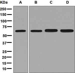 Western blot analysis on (A) fetal heart, (B) fetal liver, (C) 293T and (D) HeLa cell lysates using anti-ZNF136 antibody.