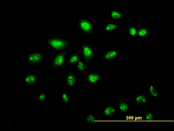 Immunofluorescence of monoclonal antibody to ZNF136 on HeLa cell. [antibody concentration 10 ug/ml]