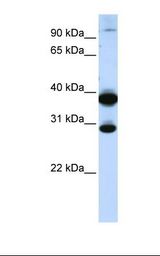 Fetal muscle lysate. Antibody concentration: 1.0 ug/ml. Gel concentration: 12%.