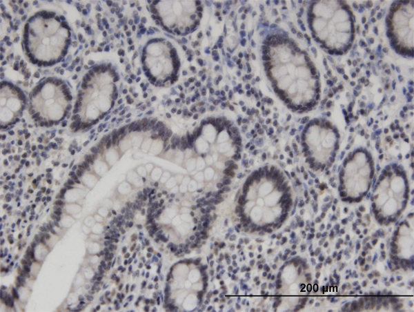 Immunoperoxidase of monoclonal antibody to ZNF138 on formalin-fixed paraffin-embedded human small Intestine. [antibody concentration 3 ug/ml]