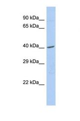 Western blot of Human 721_B. ZNF140 antibody dilution 1.0 ug/ml.