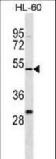 ZNF187 Antibody western blot of HL-60 cell line lysates (35 ug/lane). The ZNF187 antibody detected the ZNF187 protein (arrow).