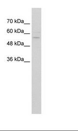 Jurkat Cell Lysate