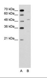 A: Marker, B: Jurkat Cell Lysate