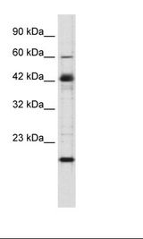 Jurkat Cell Lysate