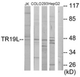 Western blot of extracts from Jurkat/COLO205/293/HepG2 cells, using RELT Antibody. The lane on the right is treated with the synthesized peptide.