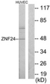 Western blot of extracts from HUVEC cells, using ZNF24 Antibody. The lane on the right is treated with the synthesized peptide.