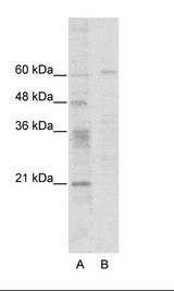 A: Marker, B: HepG2 Cell Lysate