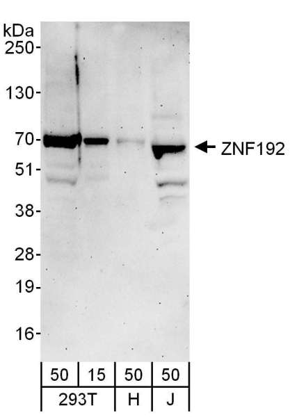 Detection of Human ZNF192 by Western Blot. Samples: Whole cell lysate from 293T (T; 50 ug), HeLa (H; 50 ug) and Jurkat (J; 50 ug) cells. Antibodies: Affinity purified rabbit anti-ZNF192 antibody used for WB at 1 ug/ml. Detection: Chemiluminescence with an exposure time of 3 minutes.