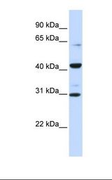 Fetal brain lysate. Antibody concentration: 1.0 ug/ml. Gel concentration: 12%.