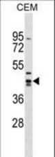 ZNF193 Antibody western blot of CEM cell line lysates (35 ug/lane). The ZNF193 antibody detected the ZNF193 protein (arrow).