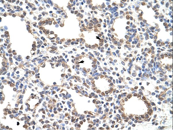 ZNF195 antibody LS-C30310 was used in IHC to stain formalin-fixed, paraffin-embedded human lung.