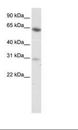 Fetal Lung Lysate